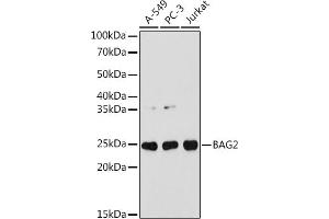 Western blot analysis of extracts of various cell lines, using B antibody (ABIN7265849) at 1:1000 dilution. (BAG2 抗体)
