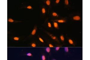 Immunofluorescence analysis of U-2 OS cells using MonoMethyl-Histone H3-K4 Polyclonal Antibody at dilution of 1:100.