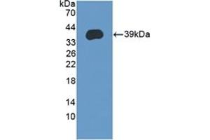 Detection of Recombinant LEAP2, Human using Polyclonal Antibody to Liver Expressed Antimicrobial Peptide 2 (LEAP2) (LEAP2 抗体  (AA 23-76))