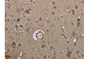 The image on the left is immunohistochemistry of paraffin-embedded Human brain tissue using ABIN7191406(MARK4 Antibody) at dilution 1/40, on the right is treated with synthetic peptide. (MARK4 抗体)
