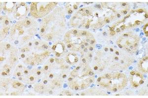 Immunohistochemistry of paraffin-embedded Mouse kidney using CSNK2A1 Polyclonal Antibody at dilution of 1:100 (40x lens). (CSNK2A1/CK II alpha 抗体)