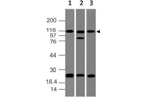 Image no. 1 for anti-NLR Family, Pyrin Domain Containing 2 (NLRP2) (AA 850-1060) antibody (ABIN5027383) (NLRP2 抗体  (AA 850-1060))