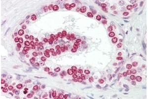 Anti-GATA4 antibody IHC staining of human prostate. (GATA4 抗体  (AA 330-380))