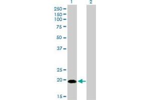 Western Blot analysis of CETN1 expression in transfected 293T cell line by CETN1 monoclonal antibody (M01), clone 2A6. (Centrin 1 抗体  (AA 1-100))