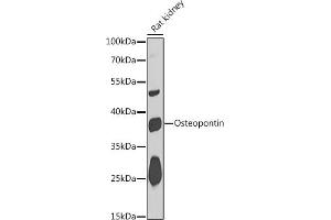 Western blot analysis of extracts of Rat kidney, using Osteopontin antibody (ABIN6132294, ABIN6148378, ABIN6148380 and ABIN6218573) at 1:1000 dilution.