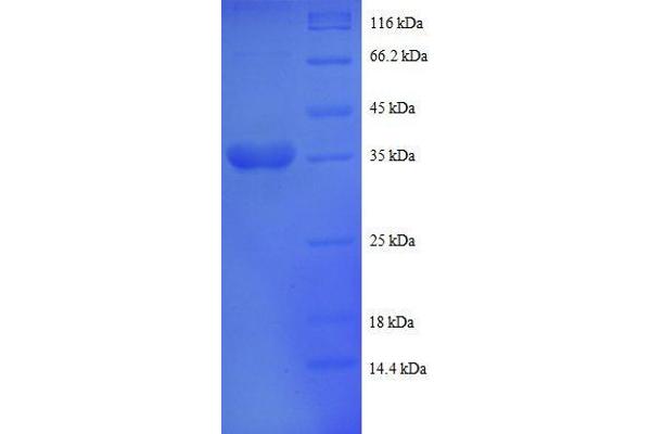 UQCRQ Protein (AA 2-78, partial) (GST tag)