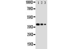 Lane 3: Recombinant Human GATA2 Protein 2. (GATA2 抗体  (N-Term))