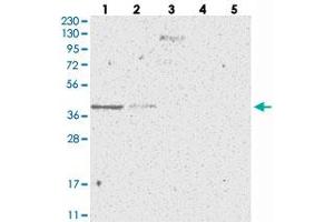 Western blot analysis of Lane 1: RT-4, Lane 2: U-251 MG, Lane 3: Human Plasma, Lane 4: Liver, Lane 5: Tonsil with SLC35A5 polyclonal antibody . (SLC35A5 抗体)