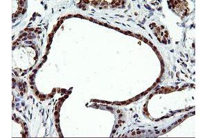 Immunohistochemistry (IHC) image for anti-EPM2A (Laforin) Interacting Protein 1 (EPM2AIP1) antibody (ABIN1498046) (EPM2AIP1 抗体)