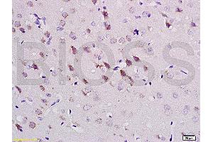 Formalin-fixed and paraffin embedded rat brain tissue labeled with Anti-CaMK2a Polyclonal Antibody (ABIN670176), Unconjugatedat 1:200, followed by conjugation to the secondary antibody and DAB staining (CAMK2A 抗体  (AA 401-478))