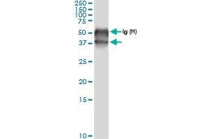 Immunoprecipitation of BCAT2 transfected lysate using anti-BCAT2 MaxPab rabbit polyclonal antibody and Protein A Magnetic Bead , and immunoblotted with BCAT2 MaxPab rabbit polyclonal antibody (D01) . (BCAT2 抗体  (AA 1-392))