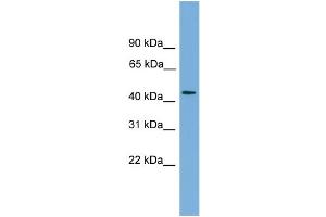WB Suggested Anti-ZNF620 Antibody Titration: 0. (ZNF620 抗体  (N-Term))