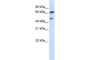 WB Suggested Anti-FOXP4 Antibody Titration:  0. (FOXP4 抗体  (N-Term))