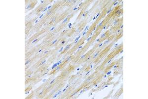 Immunohistochemistry of paraffin-embedded rat heart using CCL17 antibody (ABIN5971483) at dilution of 1/100 (40x lens). (CCL17 抗体)