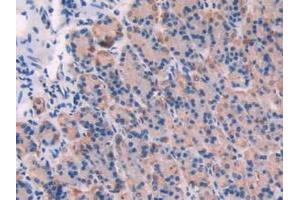 Immunohistochemistry (IHC) image for anti-Calpain 1, Large Subunit (CAPNL1) antibody (ABIN7438319)