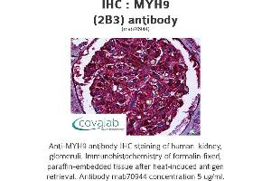 Image no. 1 for anti-Myosin 9 (MYH9) antibody (ABIN1723793) (Myosin 9 抗体)