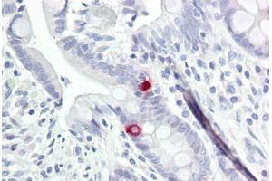 Image no. 1 for anti-Neurotrimin (NTM) (AA 91-140) antibody (ABIN6749729) (Neurotrimin 抗体  (AA 91-140))