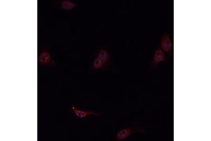 ABIN6276807 staining HepG2? (KNG1 抗体  (N-Term))