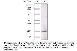 Image no. 1 for anti-Golgin A6 Family, Member A (GOLGA6A) antibody (ABIN207616) (GOLGA6A 抗体)