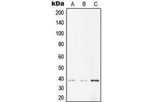 Western blot analysis of AMPK beta 1 (pS182) expression in A431 (A), NIH3T3 (B), PC12 (C) whole cell lysates.