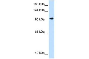 SEC63 antibody used at 1. (SEC63 抗体)