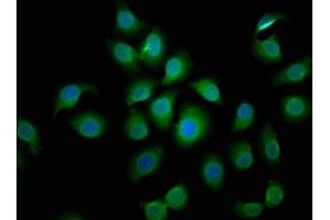 Immunofluorescence staining of A549 cells with ABIN7145298 at 1:50, counter-stained with DAPI. (BCL2L1 抗体  (AA 19-127))
