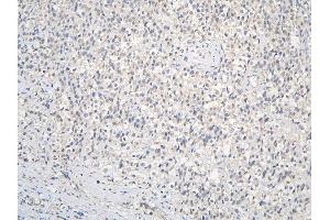 IHC analysis of CCDC36 using anti-CCDC36 antibody (ABIN6719645). (CCDC36 抗体  (AA 172-472))