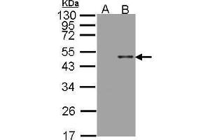WB Image Western Blot analysis of ARSB expression in transfected 293T cell line by ARSB polyclonal antibody. (Arylsulfatase B 抗体)