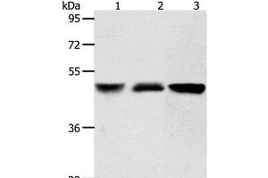 Western Blot analysis of Human brain malignant glioma and Human fetal kidney tissue, A172 cell using ACOT9 Polyclonal Antibody at dilution of 1:600 (ACOT9 抗体)