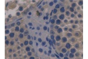 Detection of FBLN1 in Mouse Testis Tissue using Monoclonal Antibody to Fibulin 1 (FBLN1) (Fibulin 1 抗体  (AA 399-578))