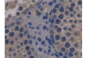 Detection of FBLN1 in Mouse Testis Tissue using Monoclonal Antibody to Fibulin 1 (FBLN1)