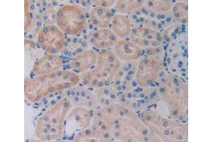Used in DAB staining on fromalin fixed paraffin- embedded kidney tissue