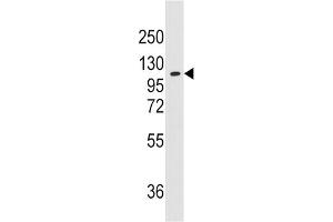 Western Blotting (WB) image for anti-Alanyl-tRNA Synthetase 2, Mitochondrial (AARS2) antibody (ABIN3003290) (AARS2 抗体)
