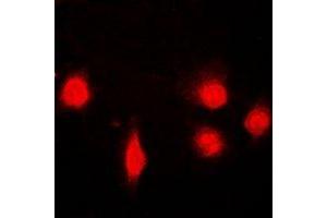 Immunofluorescent analysis of SH2B1 staining in U2OS cells. (SH2B1 抗体)