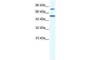 WB Suggested Anti-ZNF223 Antibody Titration:  0. (ZNF223 抗体  (N-Term))