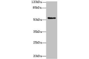 Western blot All lanes: PLEKHS1 antibody at 1. (C10orf81 抗体  (AA 181-462))