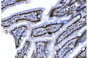 IHC analysis of CTBP2 using anti-CTBP2 antibody (ABIN7601326). (CTBP2 抗体  (AA 321-445))