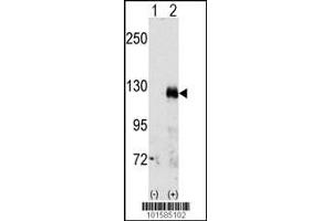 Western blot analysis of EphA3 using rabbit polyclonal EphA3 Antibody. (EPH Receptor A3 抗体  (C-Term))