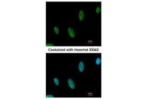 ICC/IF Image Immunofluorescence analysis of paraformaldehyde-fixed HeLa, using AF9, antibody at 1:500 dilution. (AF9 抗体  (Center))