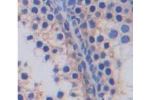 Used in DAB staining on fromalin fixed paraffin- embedded Kidney tissue (SLC2A14 抗体  (AA 1-105))