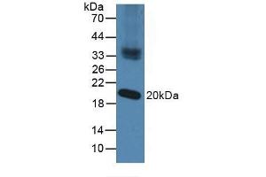 Detection of NXN in Mouse Testis Tissue using Polyclonal Antibody to Nucleoredoxin (NXN) (NXN 抗体  (AA 166-327))