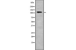 Western blot analysis of TSH1 using A549 whole cell lysates (TSHZ1 抗体  (Internal Region))