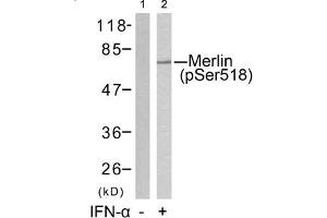 Western blot analysis of extracts from HUVEC cells untreated(lane 1) or treated with IFN-a(lane 2) using Merlin(Phospho-Ser518) Antibody.