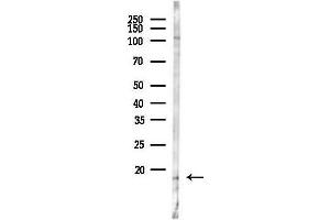 anti-Mitochondrial Ribosomal Protein L14 (MRPL14) (C-Term) antibody