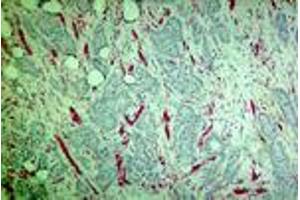 Carcinoma of the breast (MAb CE6, PECAM-1) (CD31 抗体)