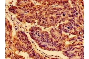 Immunohistochemistry (IHC) image for anti-Neurotrophic Tyrosine Kinase, Receptor, Type 1 (NTRK1) (AA 33-208) antibody (ABIN7155192)