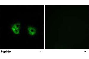 Immunofluorescence analysis of A-549 cells, using MARCH2 polyclonal antibody . (MARCH2 抗体)