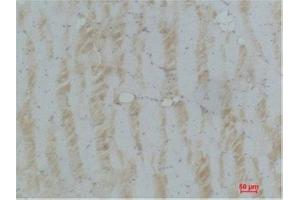 anti-Immunoglobulin-Like and Fibronectin Type III Domain Containing 1 (IGFN1) antibody