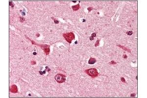 Immunohistochemistry (IHC) image for anti-Podoplanin (PDPN) (AA 1-206), (N-Term) antibody (ABIN302234) (Podoplanin 抗体  (N-Term))