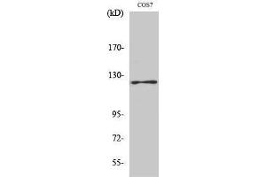 Western Blotting (WB) image for anti-PTK2 Protein tyrosine Kinase 2 (PTK2) (pTyr861) antibody (ABIN3179438) (FAK 抗体  (pTyr861))